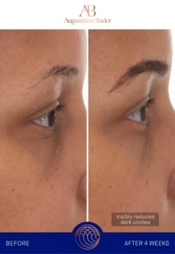 Augustinus Bader The Eye Patches Single SachetCura Degli Occhi- Uomo Cura Del Viso AUH34G010-S11 -Vendite KORRES 0e92eff674b04196af246319a5250d82