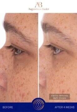 Augustinus Bader The Eye Patches Single SachetCura Degli Occhi- Uomo Cura Del Viso AUH34G010-S11 -Vendite KORRES 2d1ae08c7d0449a7b0a46ce26a2fe2d4