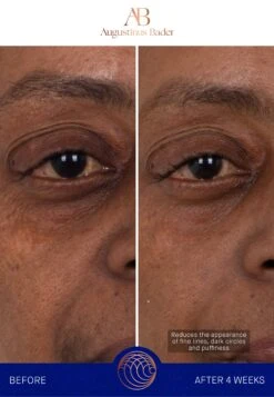 Augustinus Bader The Eye Patches Single SachetCura Degli Occhi- Uomo Cura Del Viso AUH34G010-S11 -Vendite KORRES 408ce603588745e1a8169f2bdc9c001c