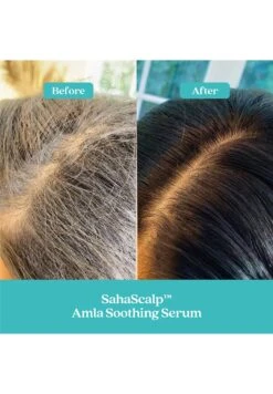 Fable & Mane Sahascalp™Siero Lenitivo Con AmlaTrattamenti Capelli- Uomo Prodotti Per Capelli F3W34H001-A11 -Vendite KORRES 7537048fb8ac4e1b99697b80ed9aeceb