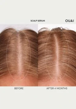 Ouai Scalp SerumTrattamenti CapelliN/A Uomo Prodotti Per Capelli OU734H00Z-S11 -Vendite KORRES 7e0aeb40990a4c76aaf0aa4883093332