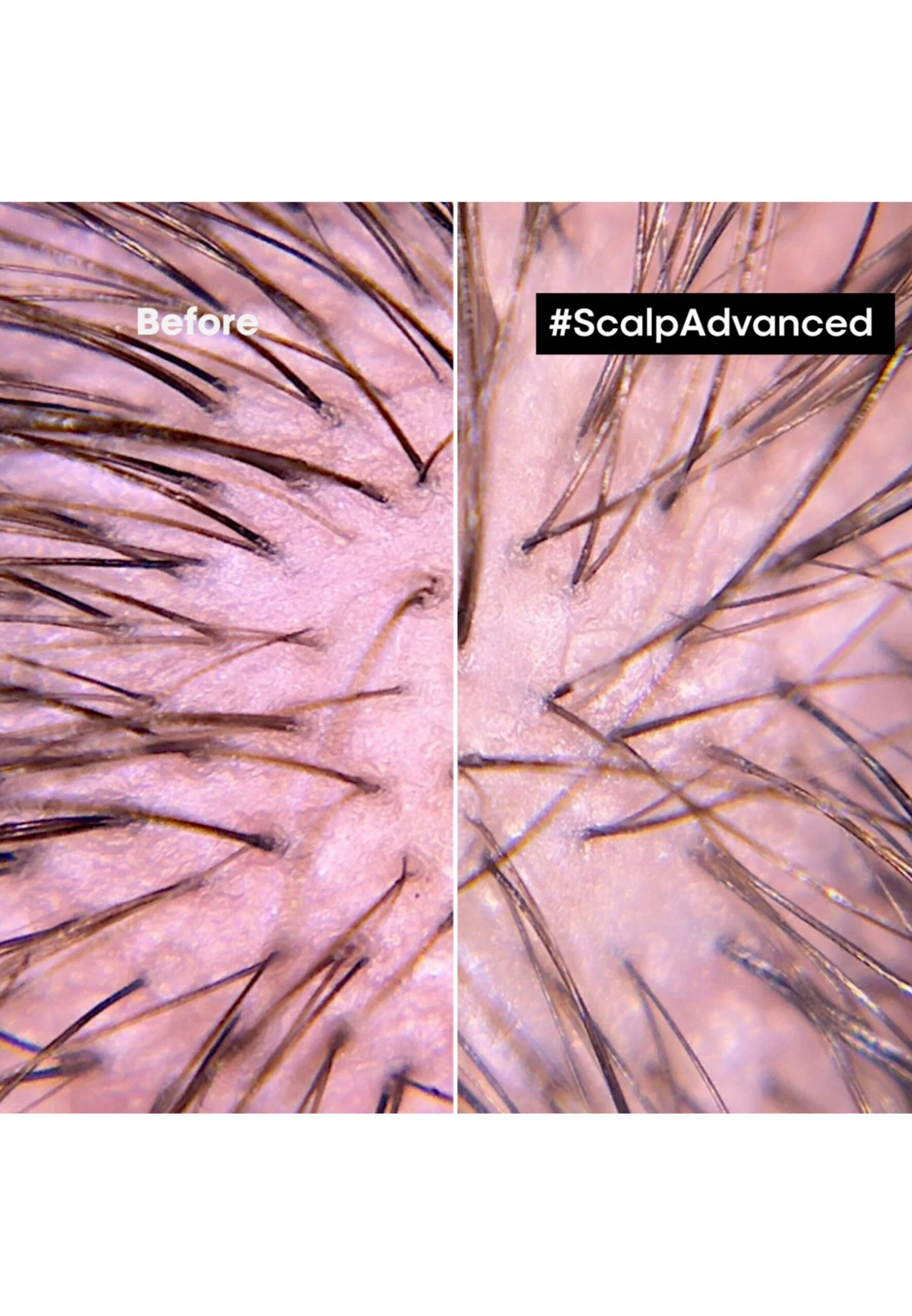 Serie Expert Scalp Advanced Anti-Discomfort For Sensitive ScalpShampoo- Uomo Prodotti Per Capelli L1Z34H05R-S11 8 Serie Expert Scalp Advanced Anti-Discomfort For Sensitive ScalpShampoo- Uomo Prodotti Per Capelli L1Z34H05R-S11 - immagine 6