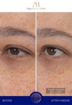 Augustinus Bader The Eye Patches Single SachetCura Degli Occhi- Uomo Cura Del Viso AUH34G010-S11 -Vendite KORRES b2faca7eb15144dea121b01ce98795f6