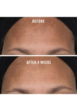 First Aid Beauty Facial Radiance Niacinamide Dark Spot SerumSSieroTransparent Uomo Cura Del Viso FIS34G013-A11 -Vendite KORRES f2333e2f5d994c42a775a2657924ec4c